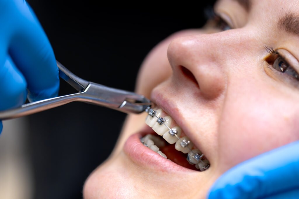 Orthodontic treatment
