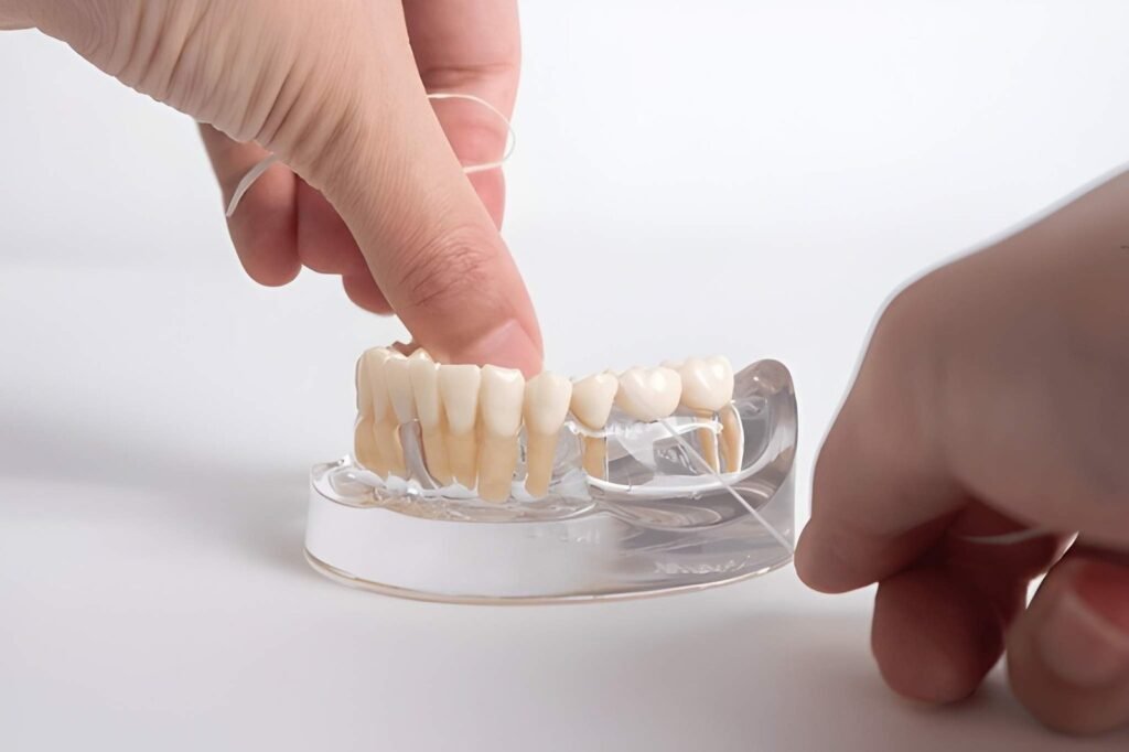 dental bridges